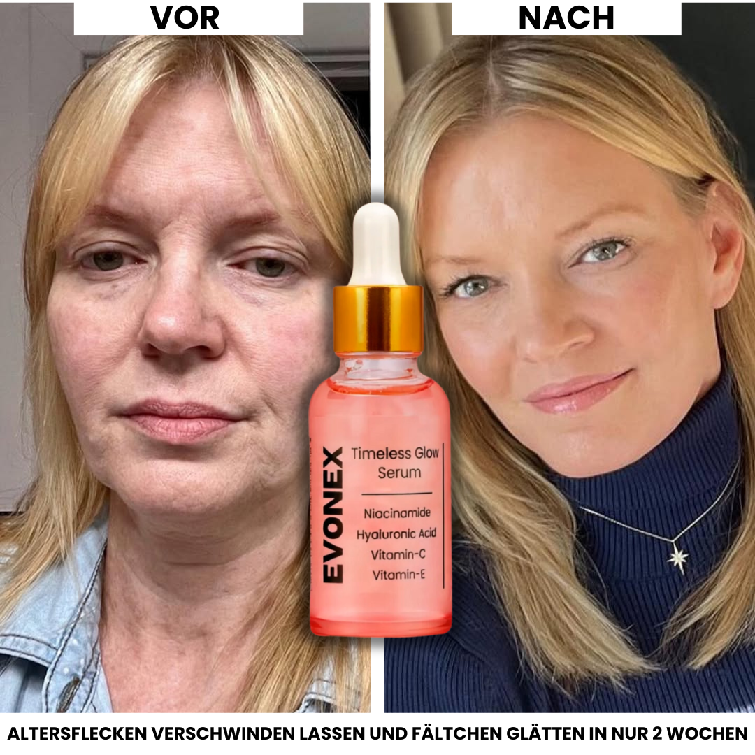 Evonex® Timeless Glow™ Serum