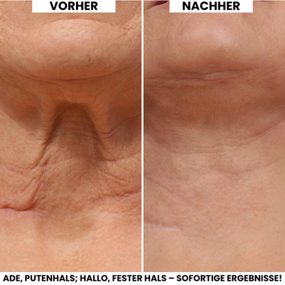 Evonex® Straffende™ Halscreme
