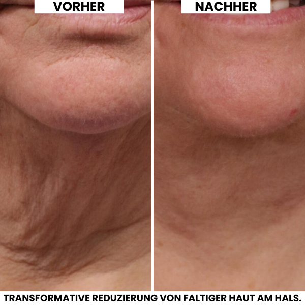 Evonex® Straffende™ Halscreme