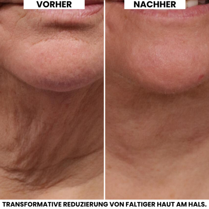 Evonex® Straffende™ Halscreme