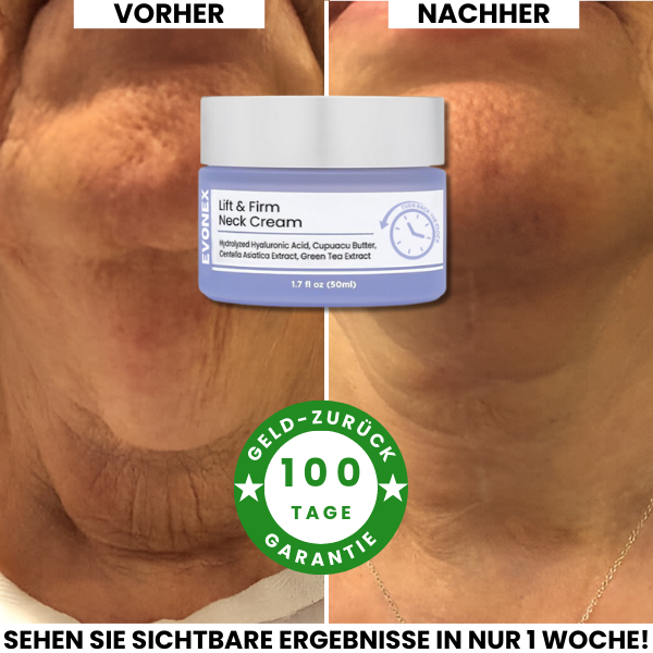 Evonex® Straffende™ Halscreme